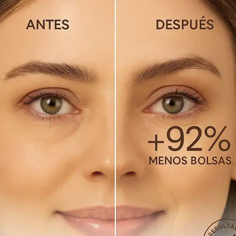 Contorno de Ojos DermoHelp | Reduce Ojeras, Bolsas y Líneas Finas
