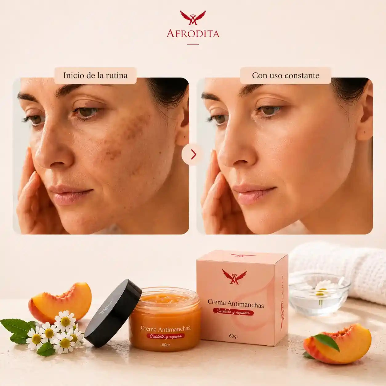 Crema Anti Manchas Afrodita – Rutina facial para manchas, tono desigual y signos de edad